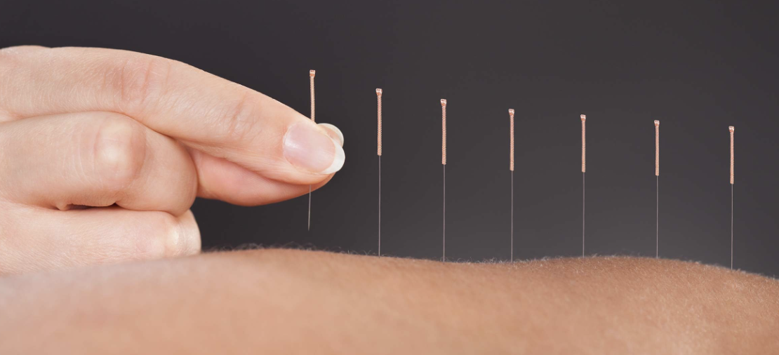 Sekilas Tentang - Perhimpunan Dokter Spesialis Akupunktur Medik Indonesia Sekilas Tentang - Perhimpunan Dokter Spesialis Akupunktur Medik Indonesia